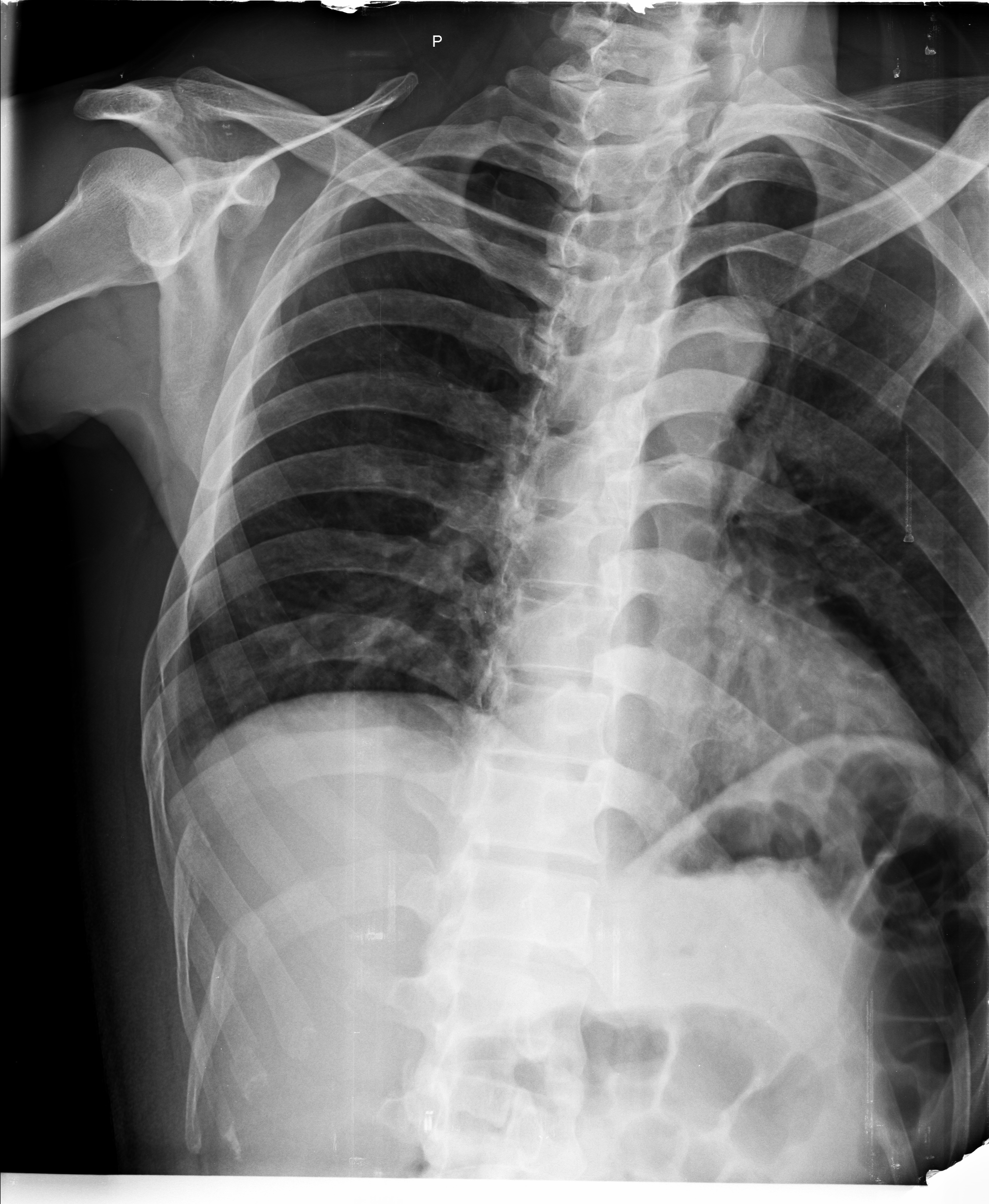 Ảnh 1