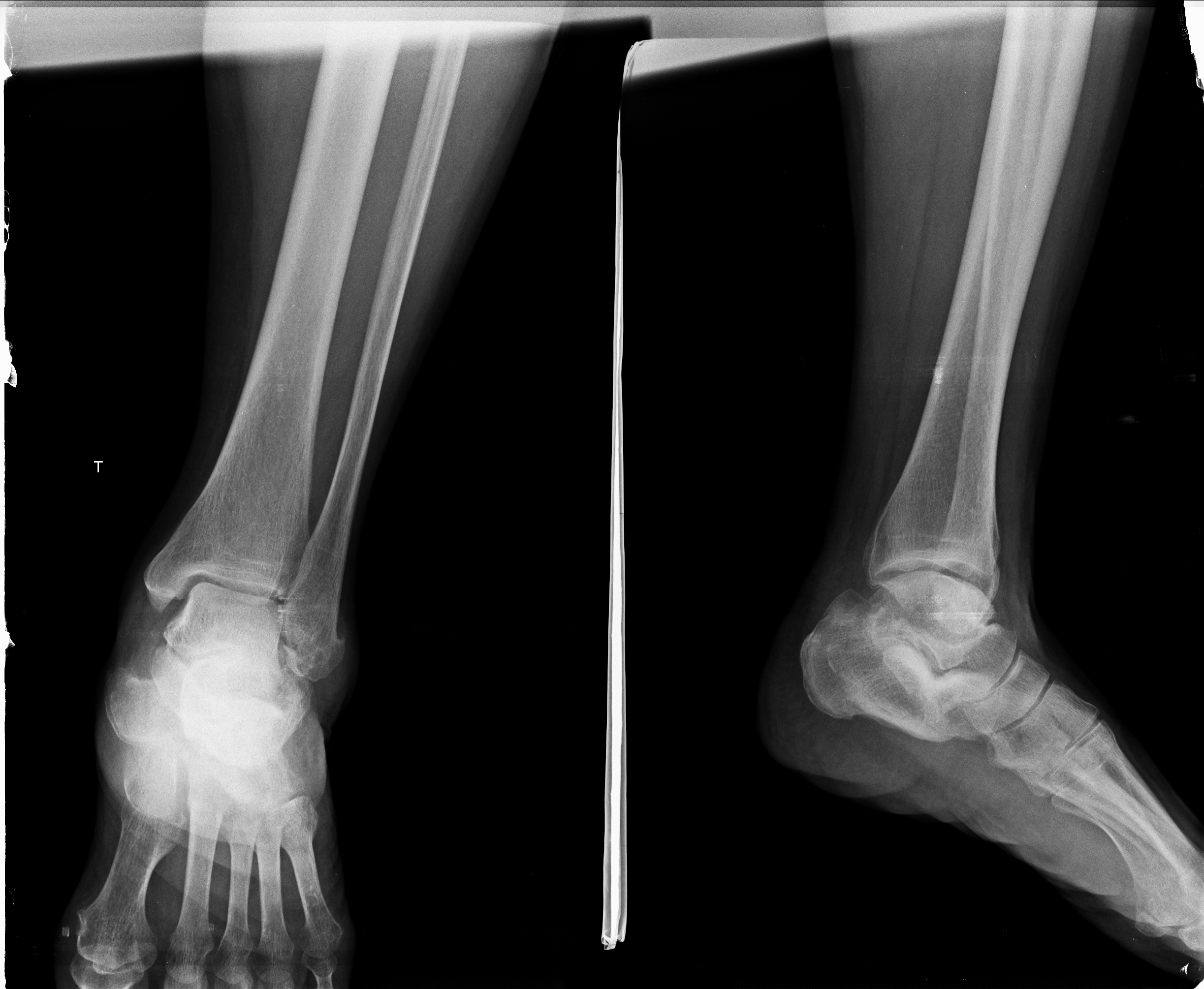 Ảnh 1