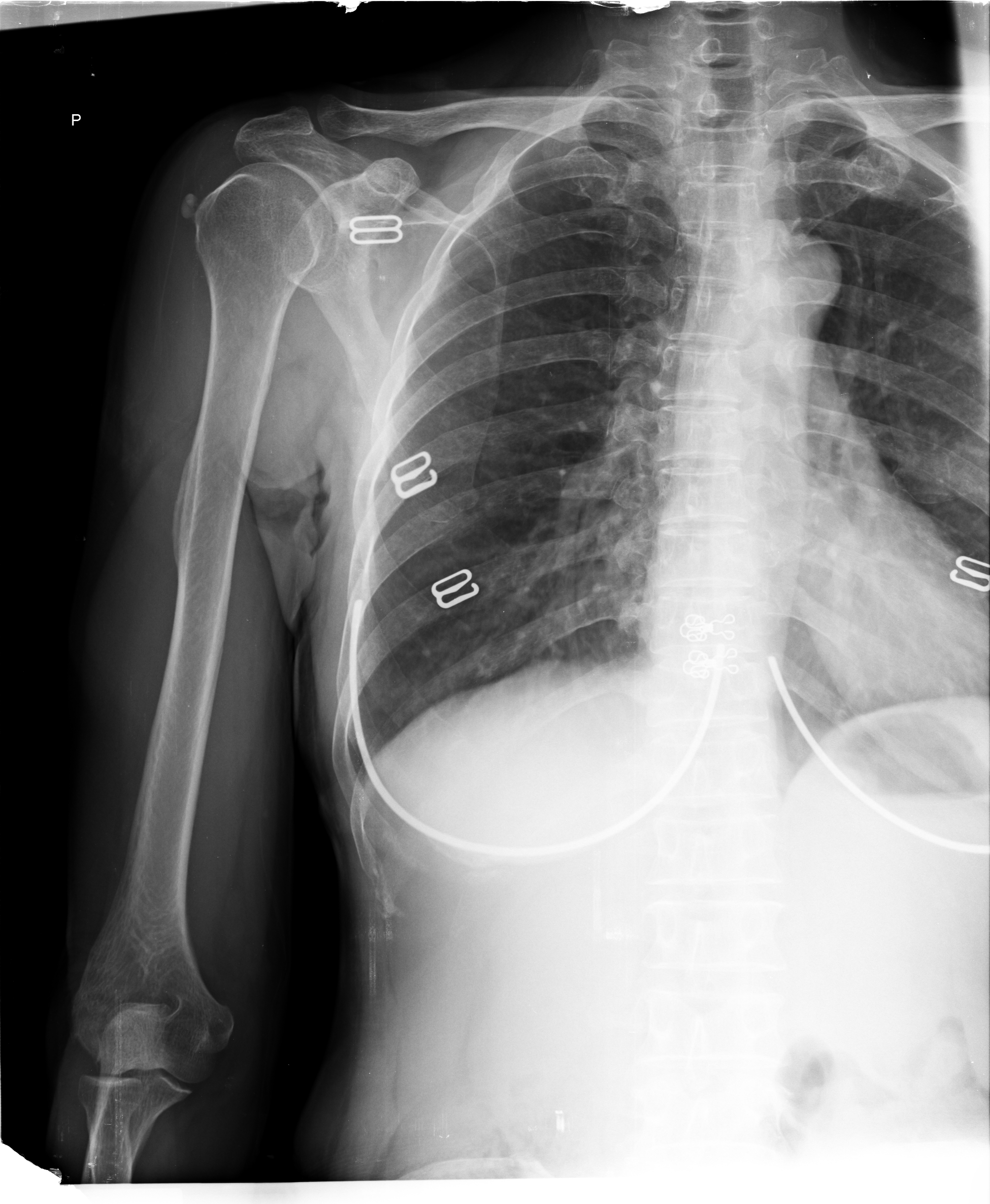 Ảnh 1