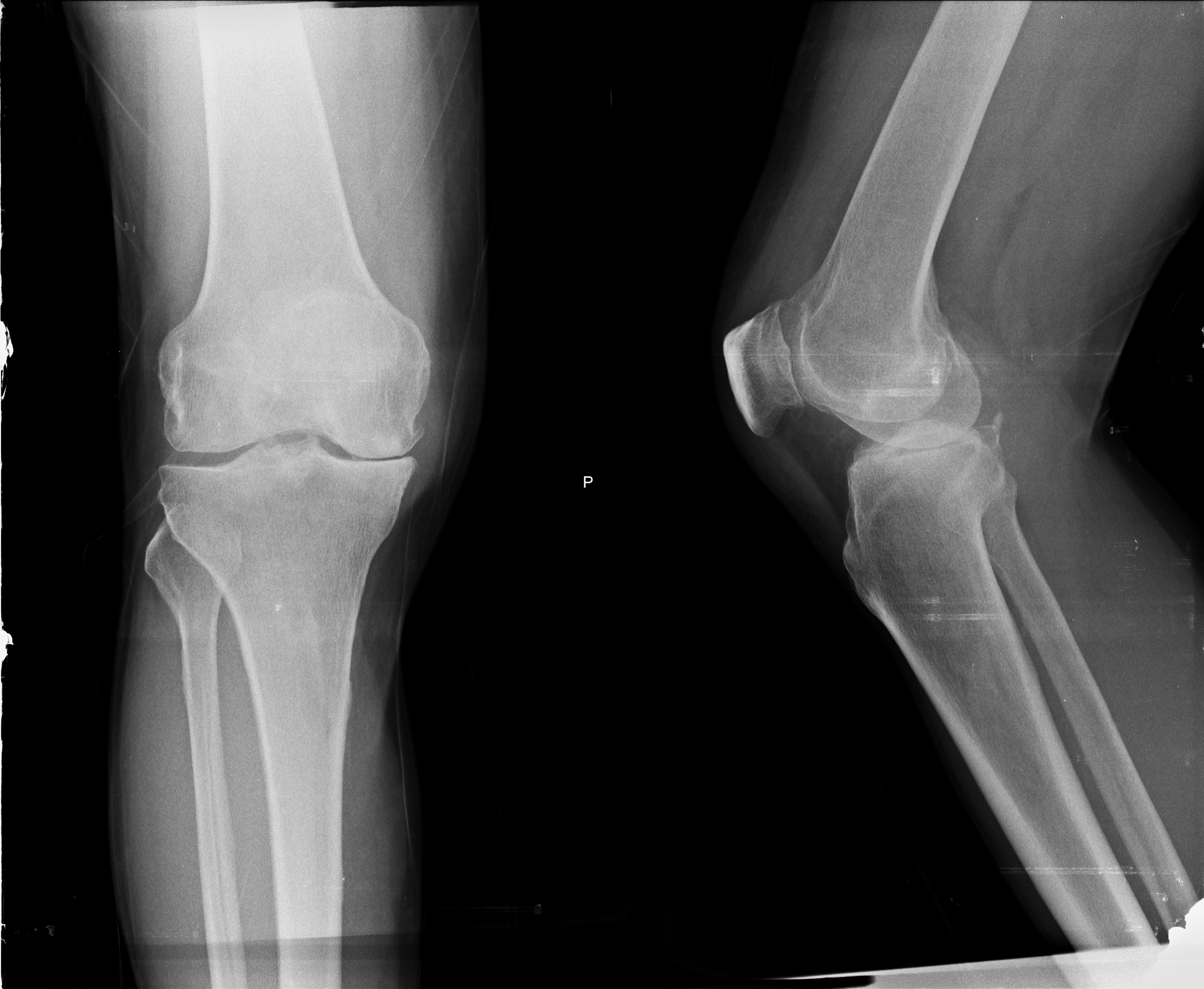 Ảnh 1