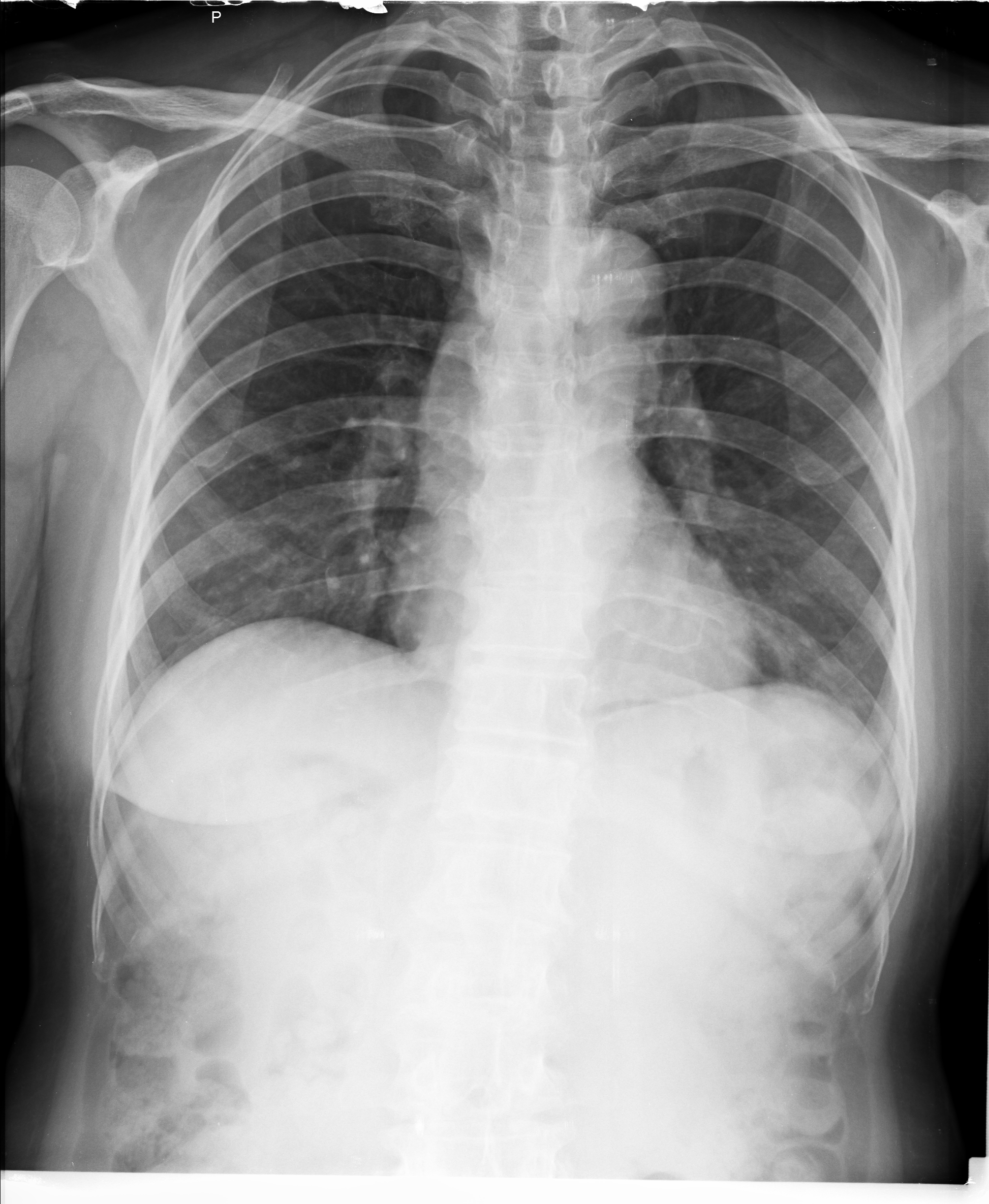 Ảnh 1