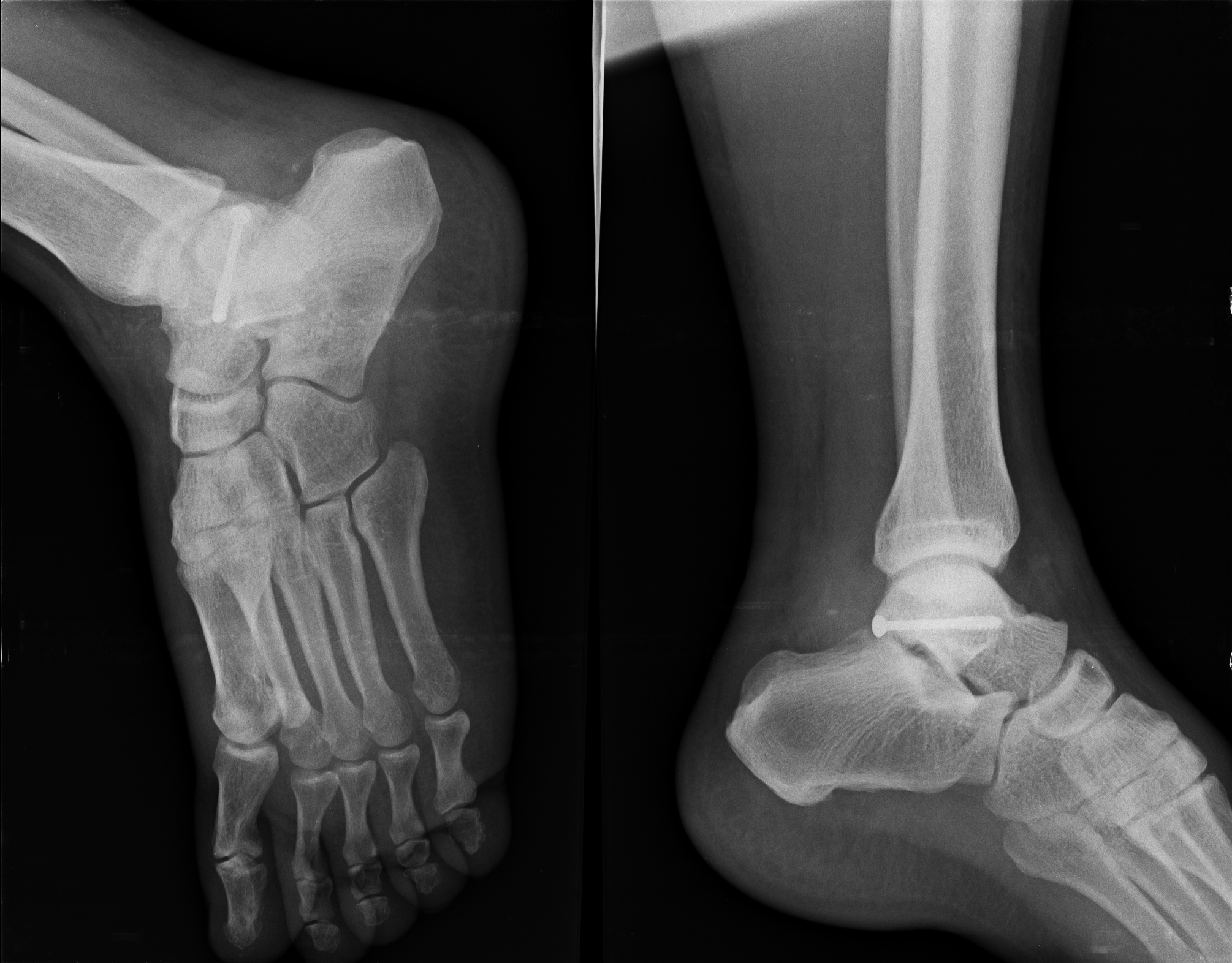 Ảnh 1