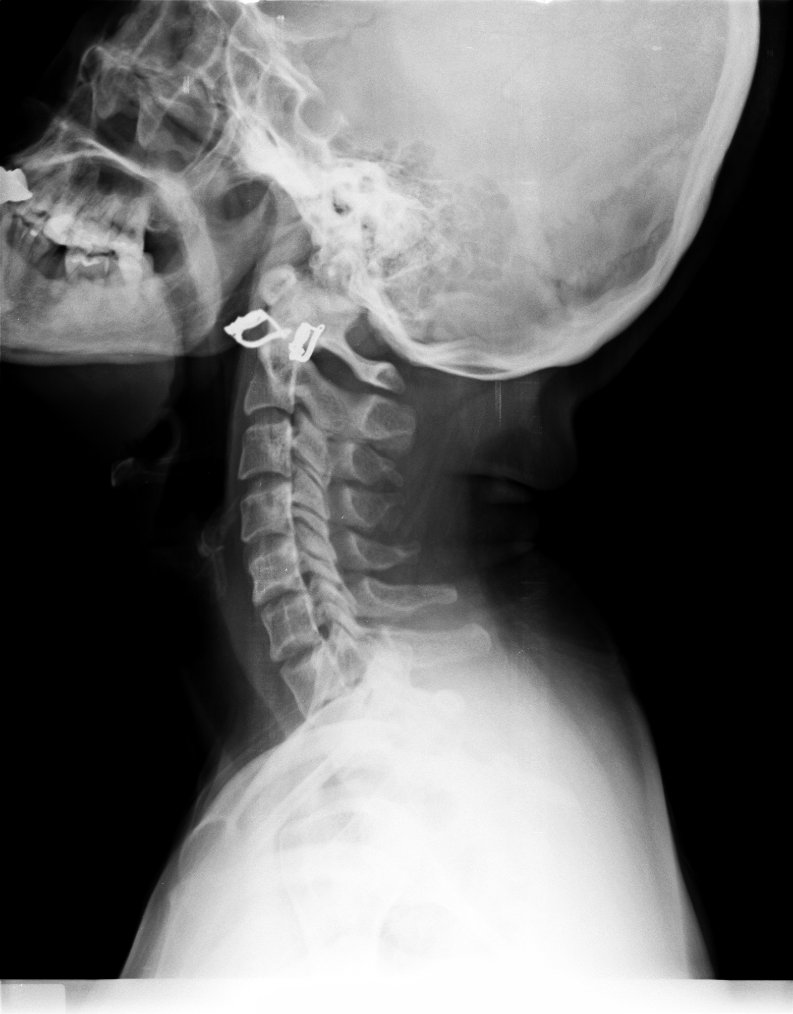 Ảnh 1
