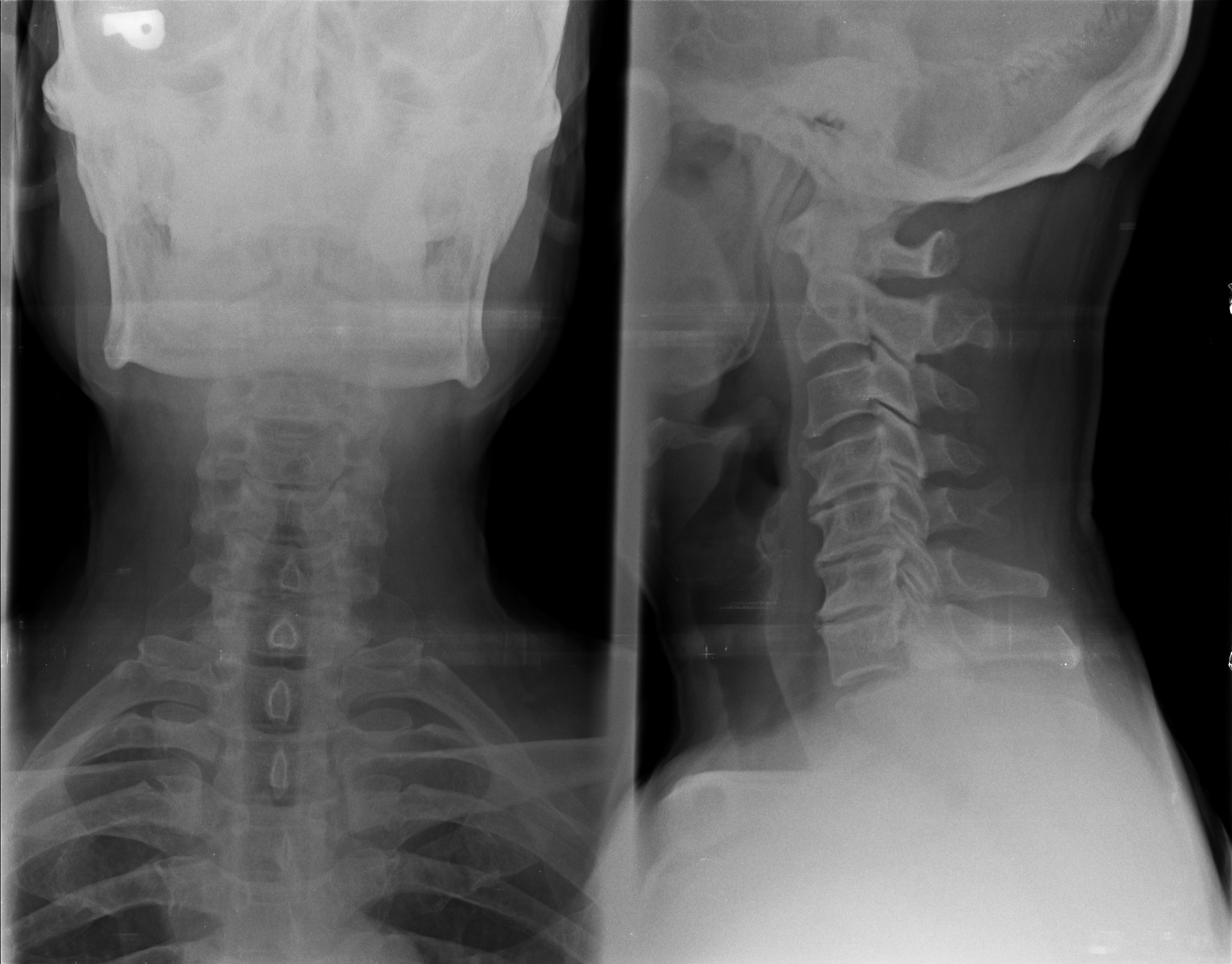 Ảnh 1