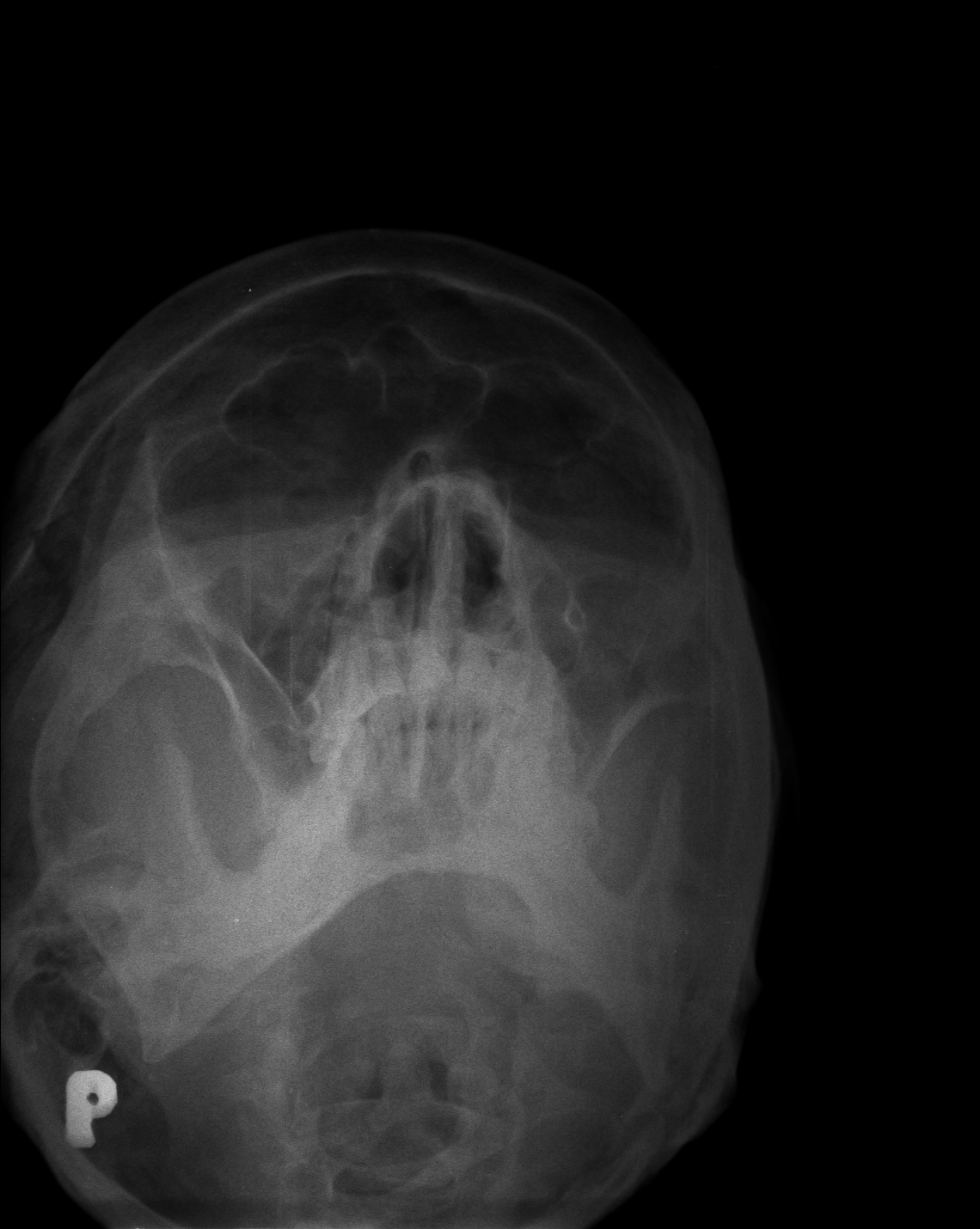 Ảnh 1