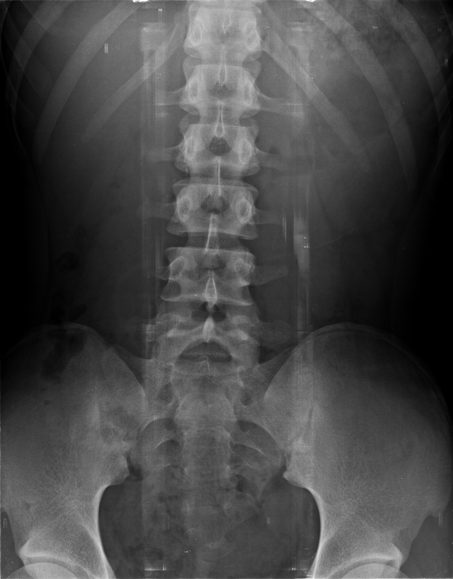 Ảnh 1