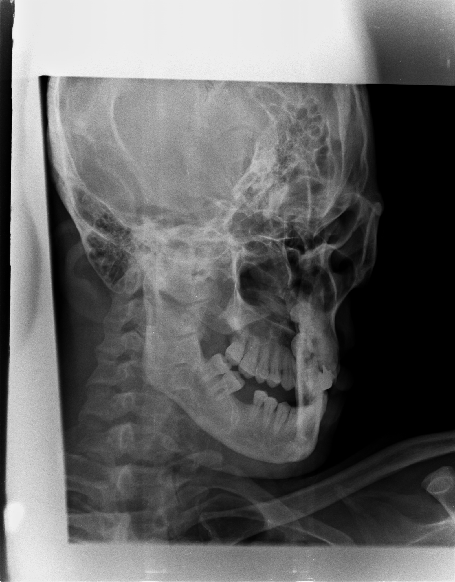 Ảnh 1