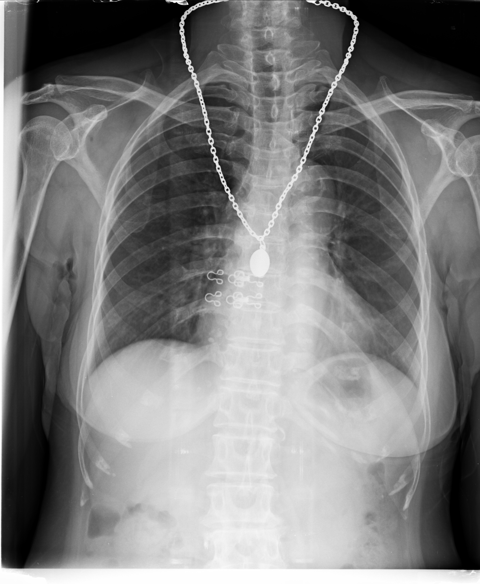 Ảnh 1