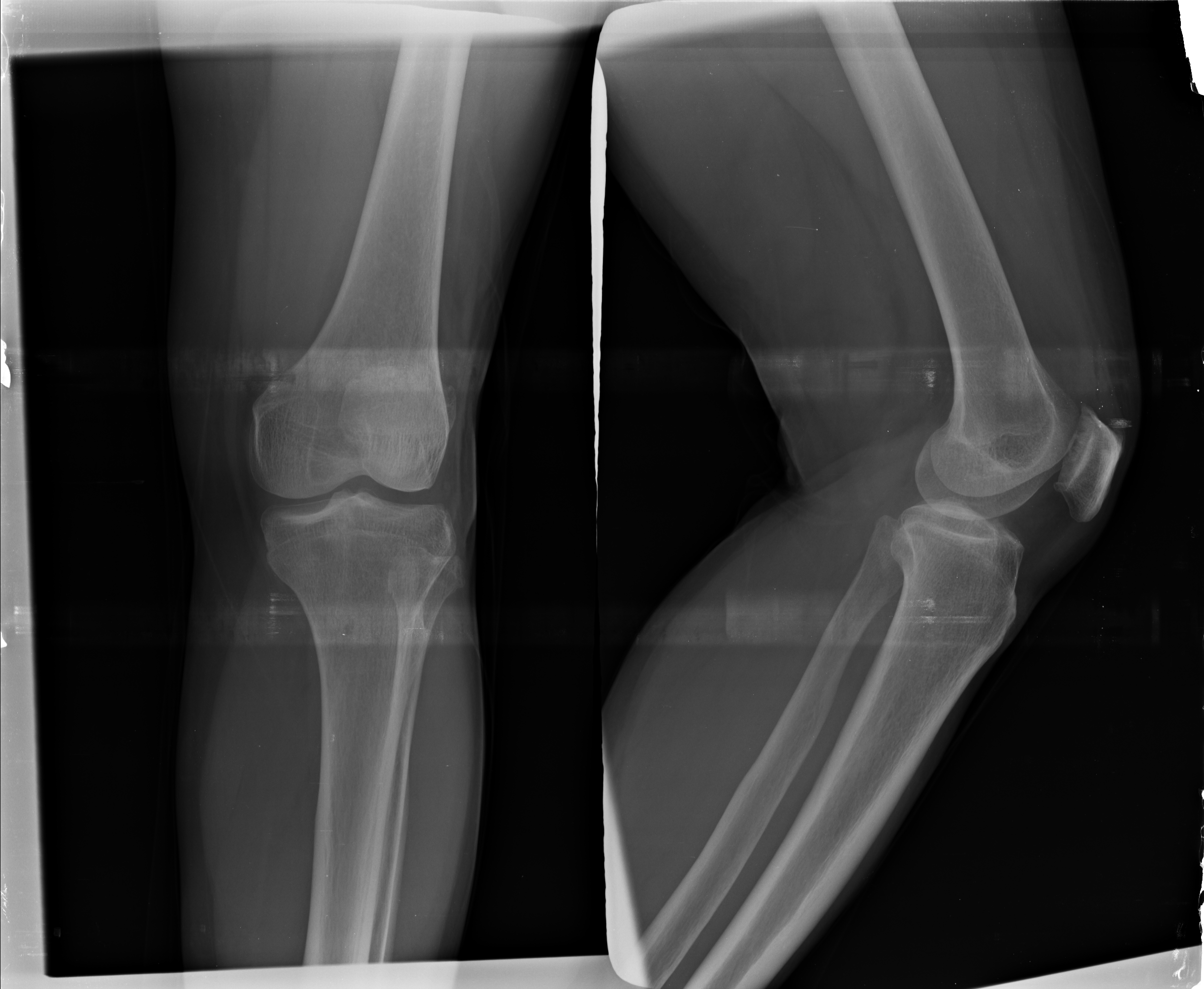 Ảnh 1
