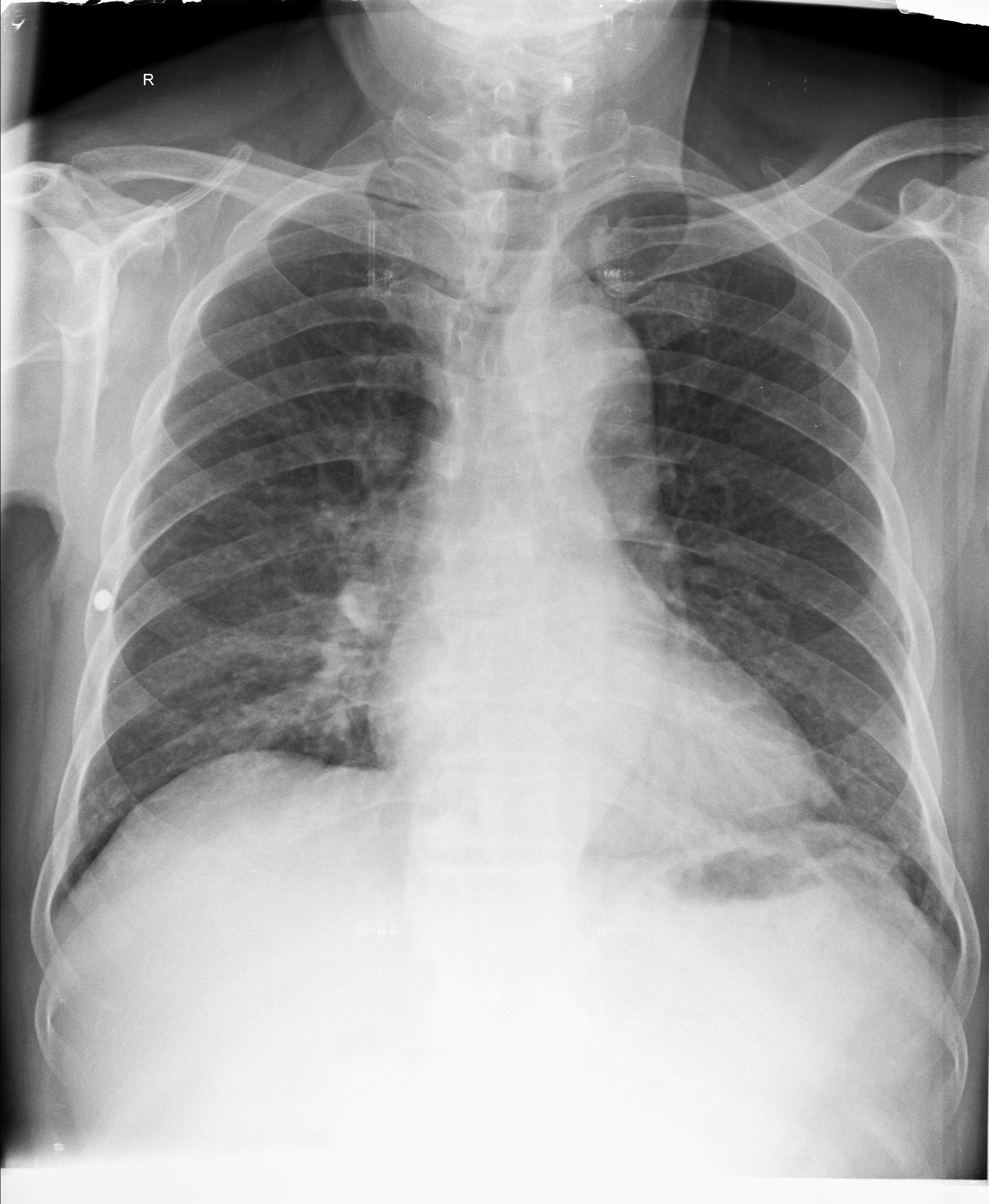 Ảnh 1