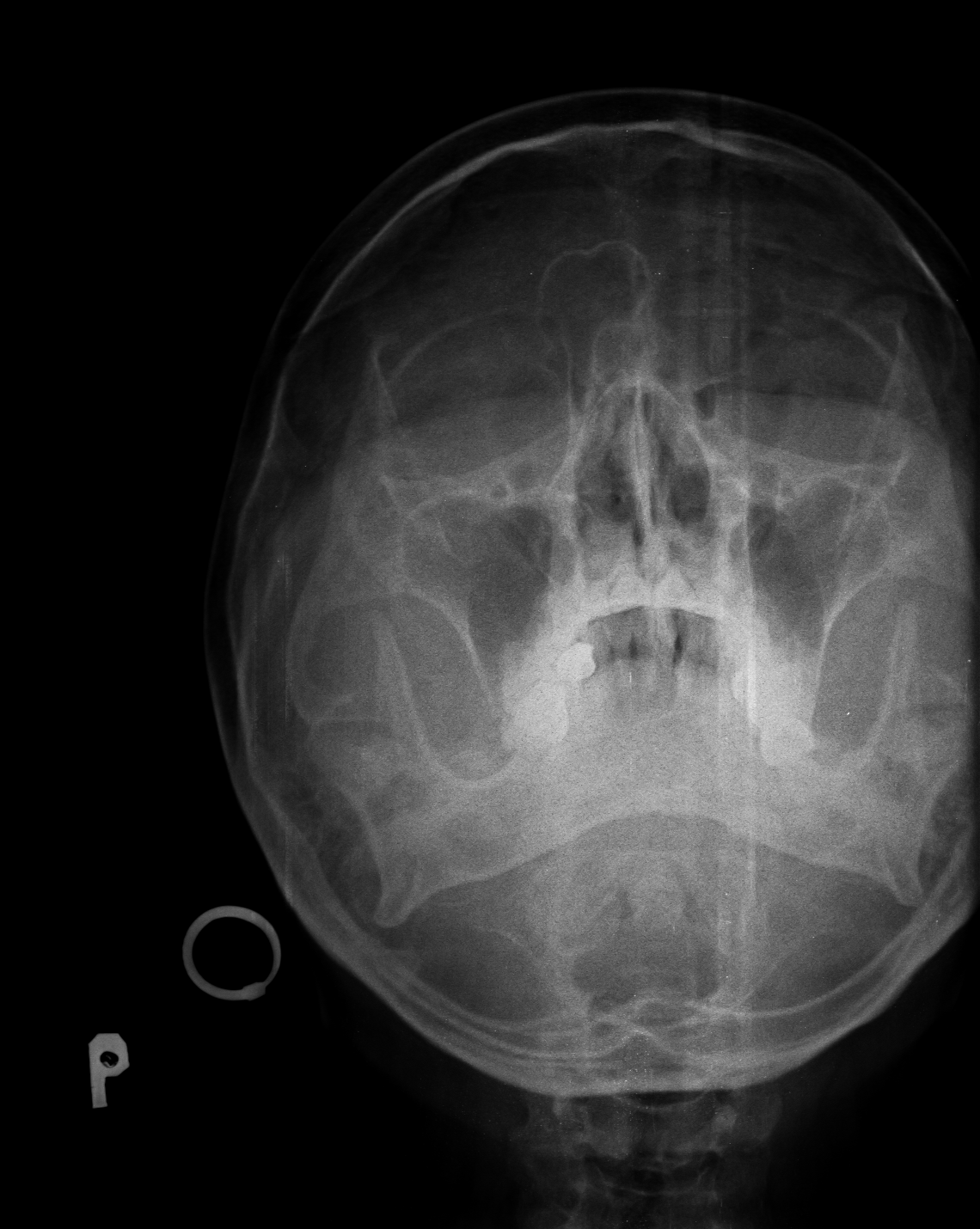 Ảnh 1