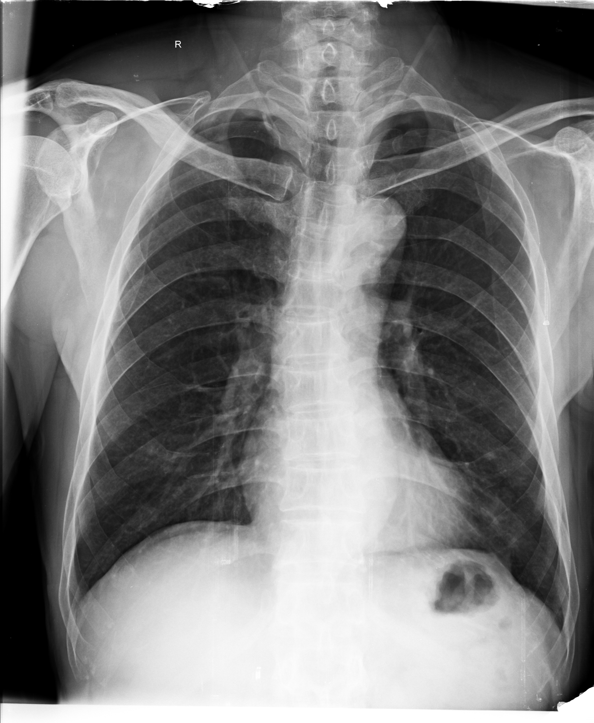 Ảnh 1