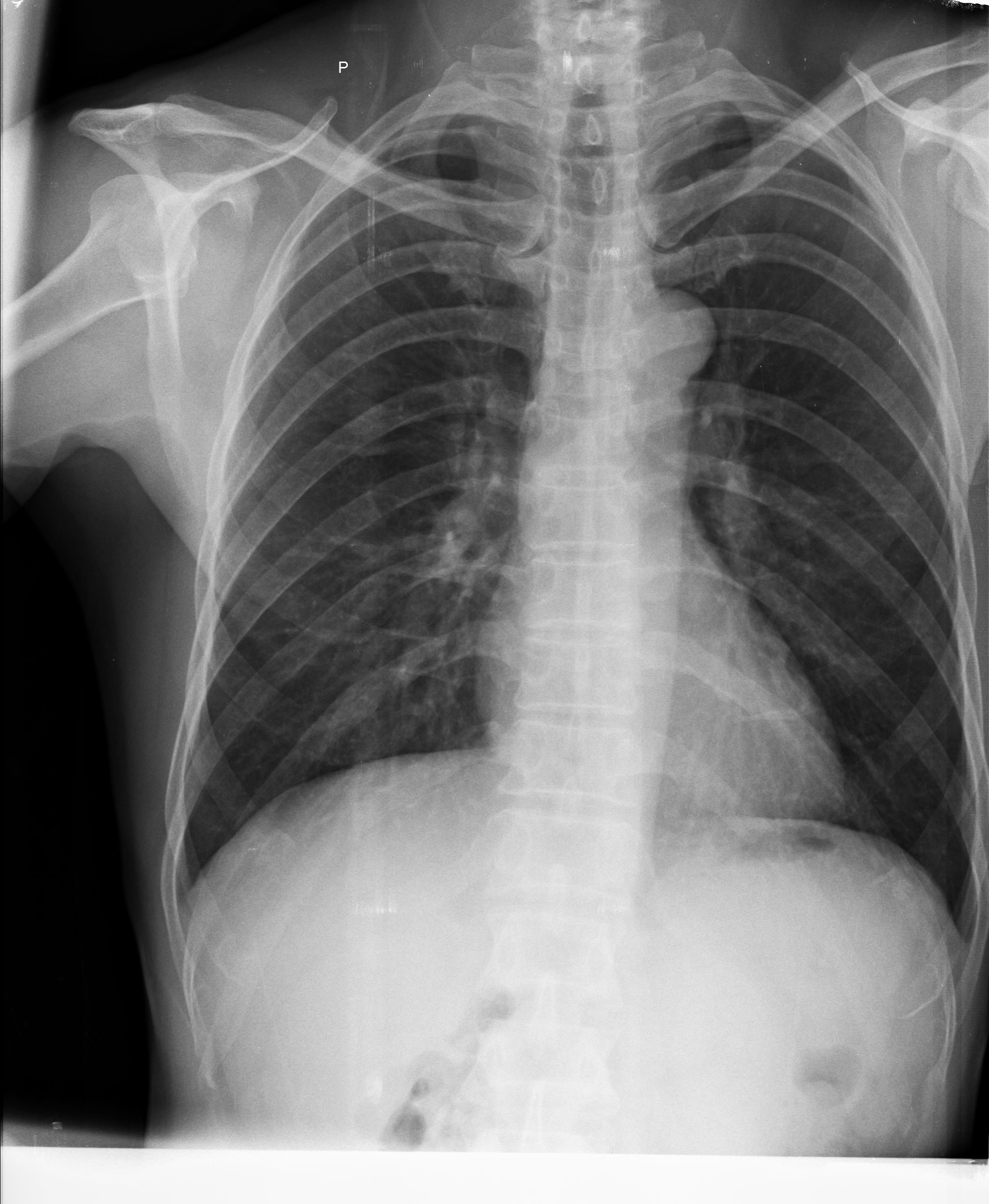 Ảnh 1
