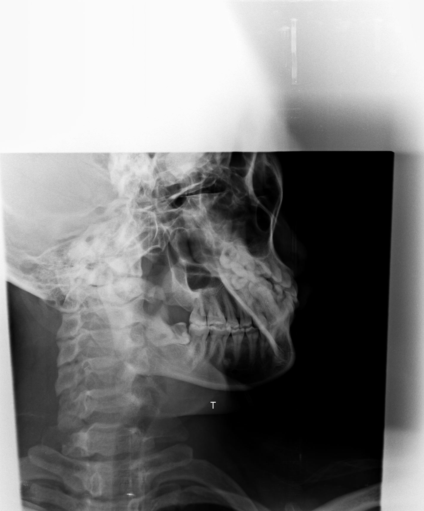 Ảnh 1