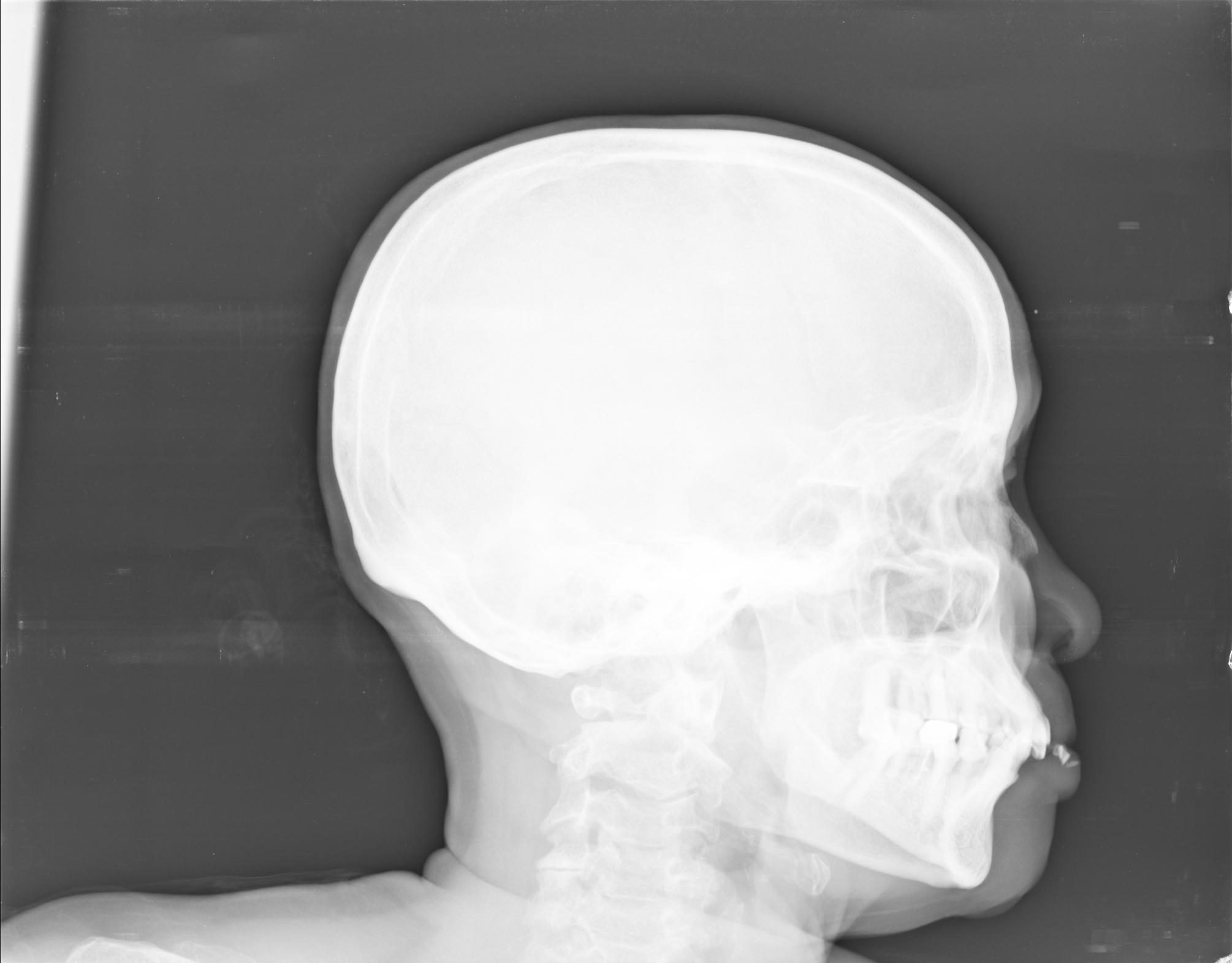 Ảnh 1