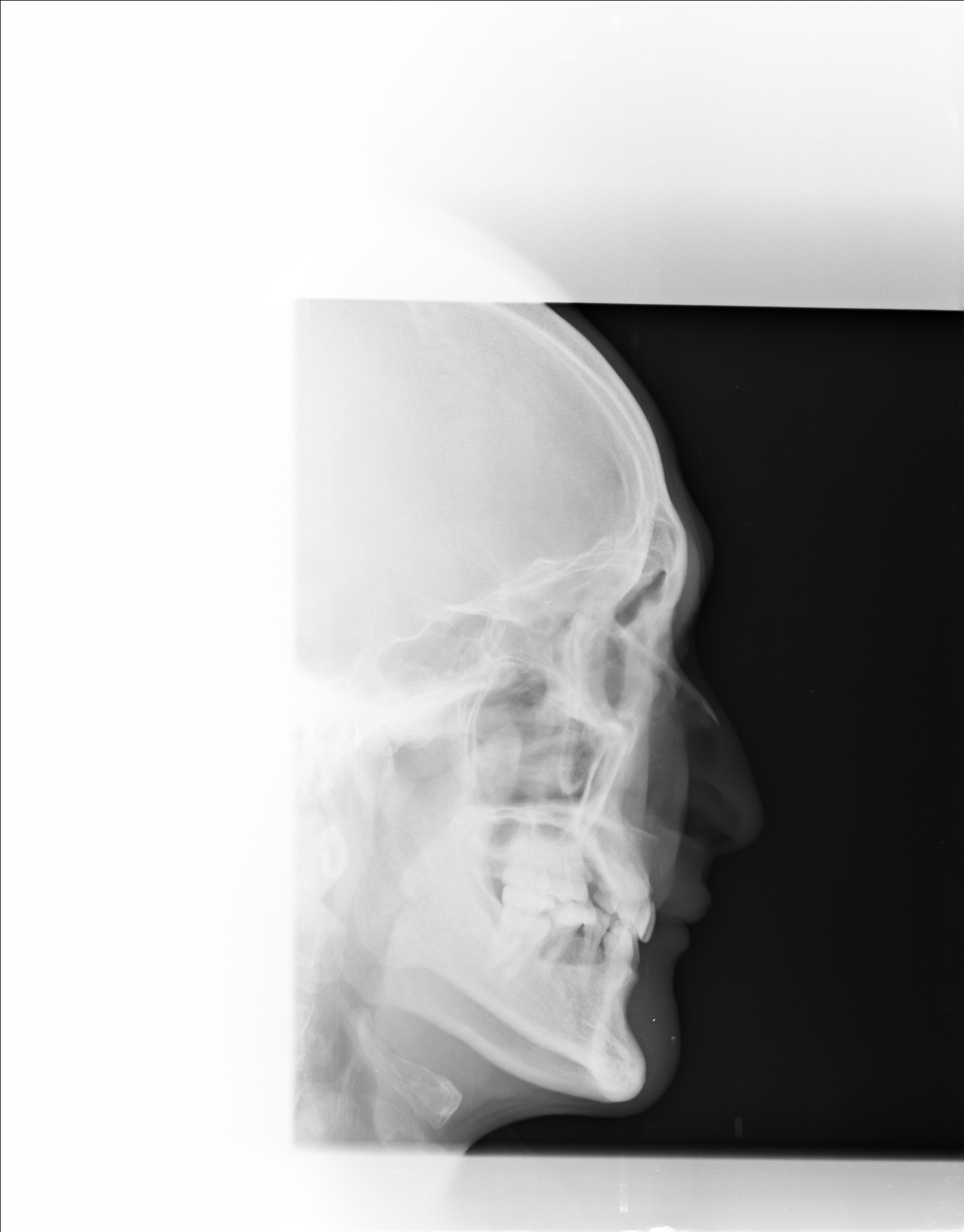 Ảnh 1