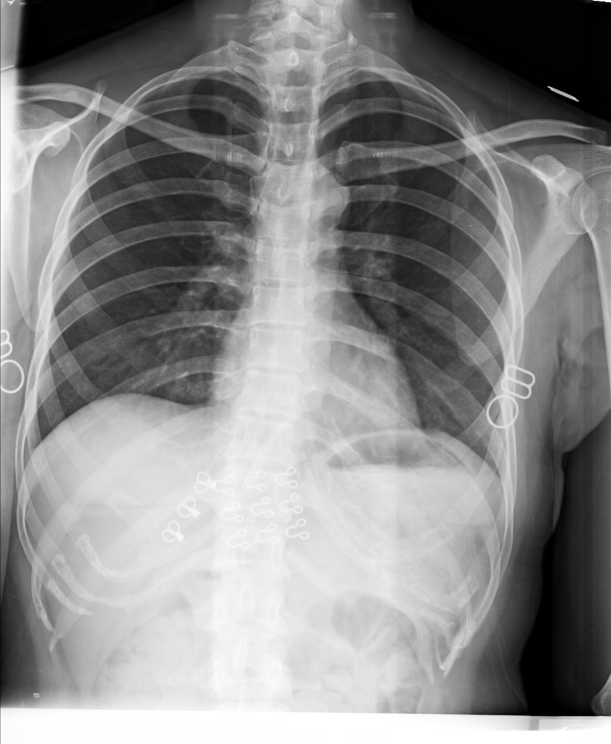 Ảnh 1