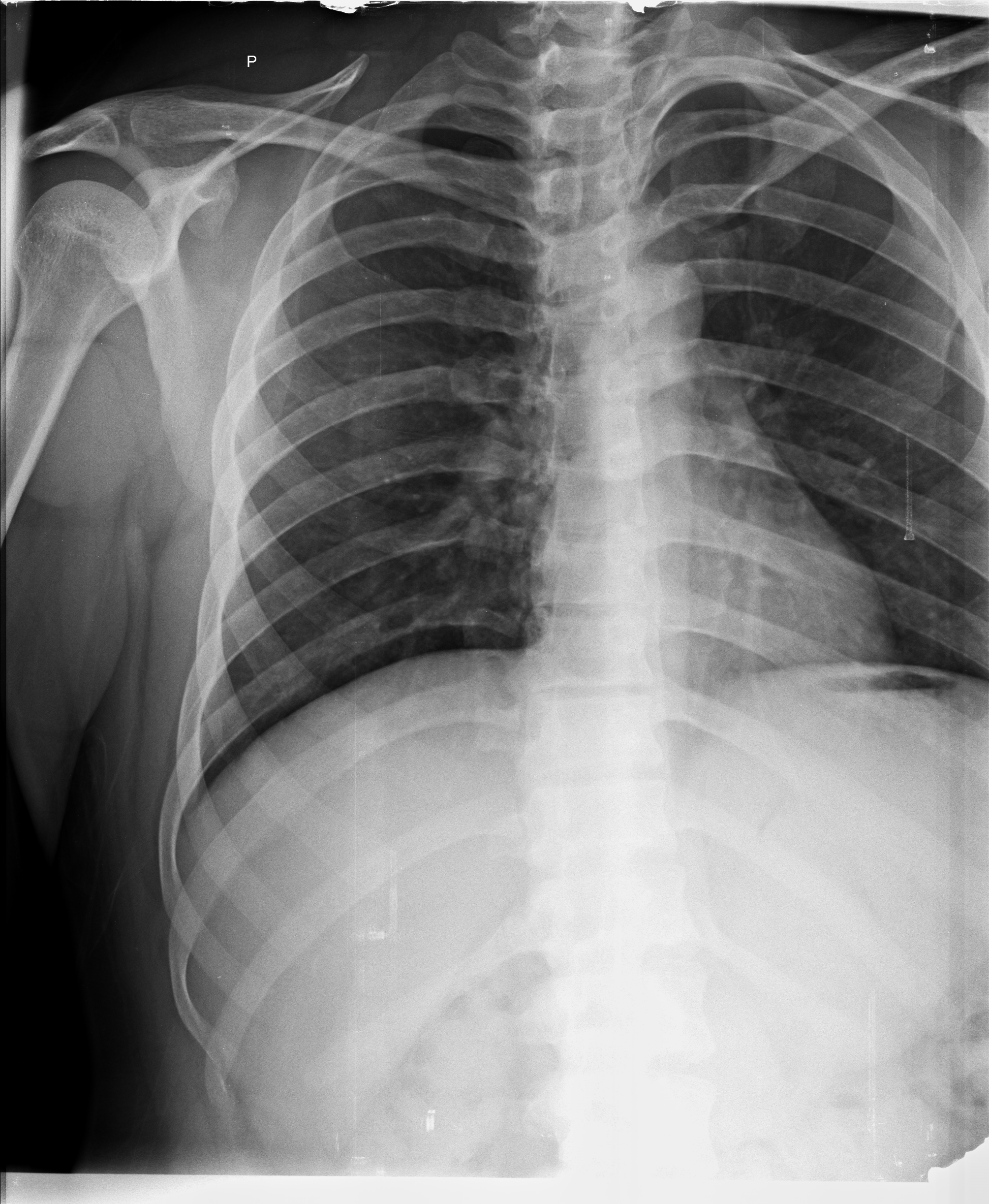 Ảnh 1