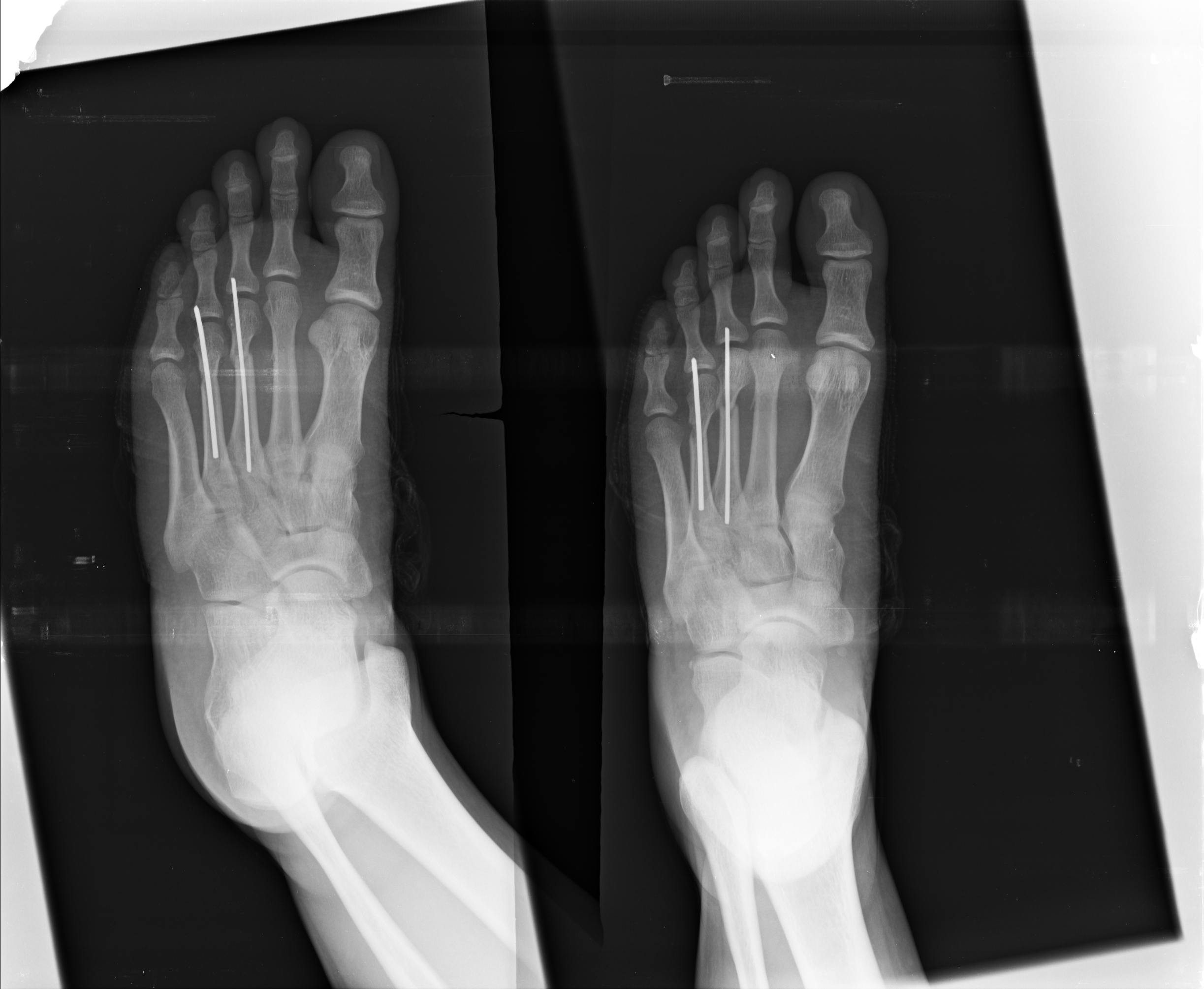 Ảnh 1