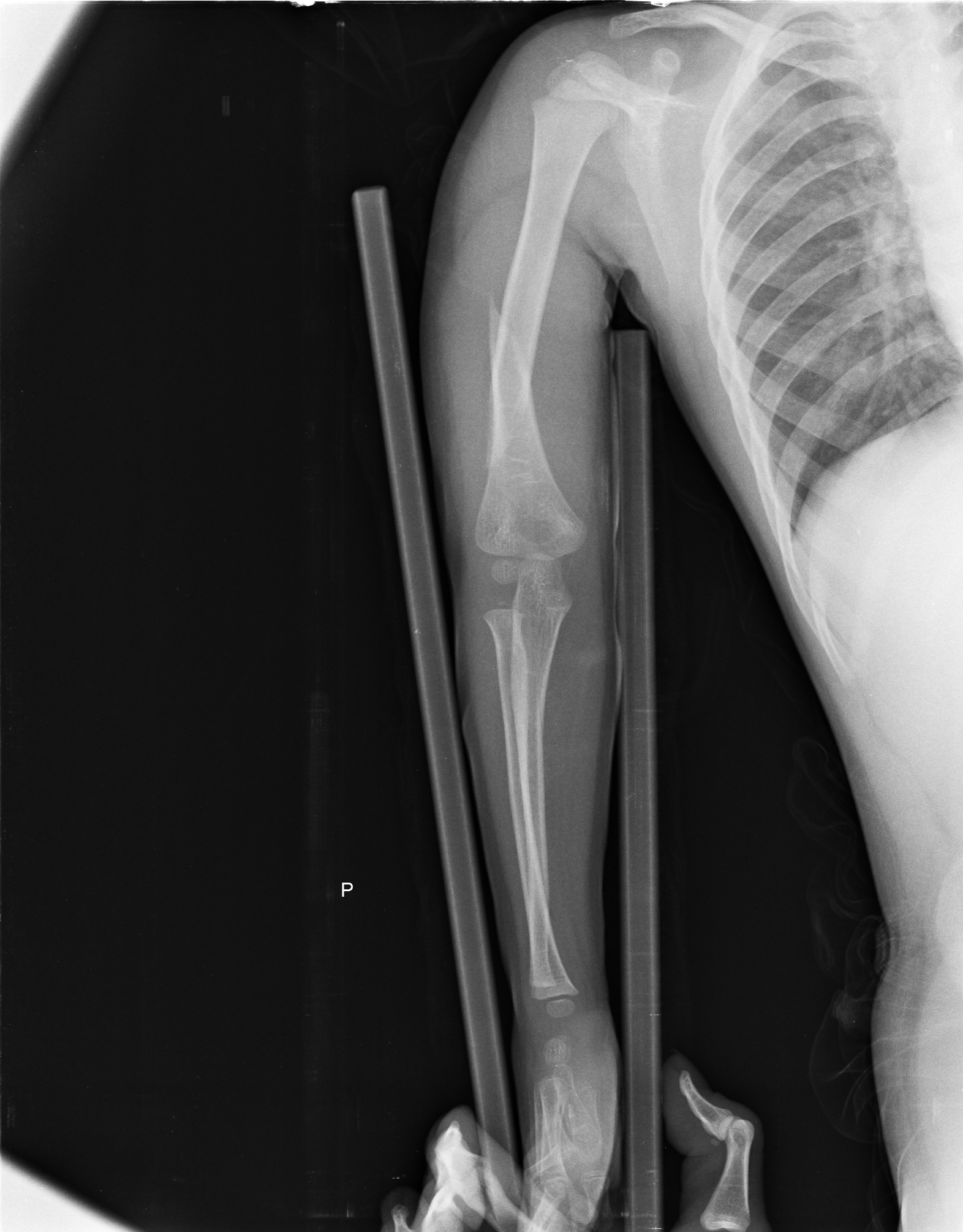 Ảnh 1
