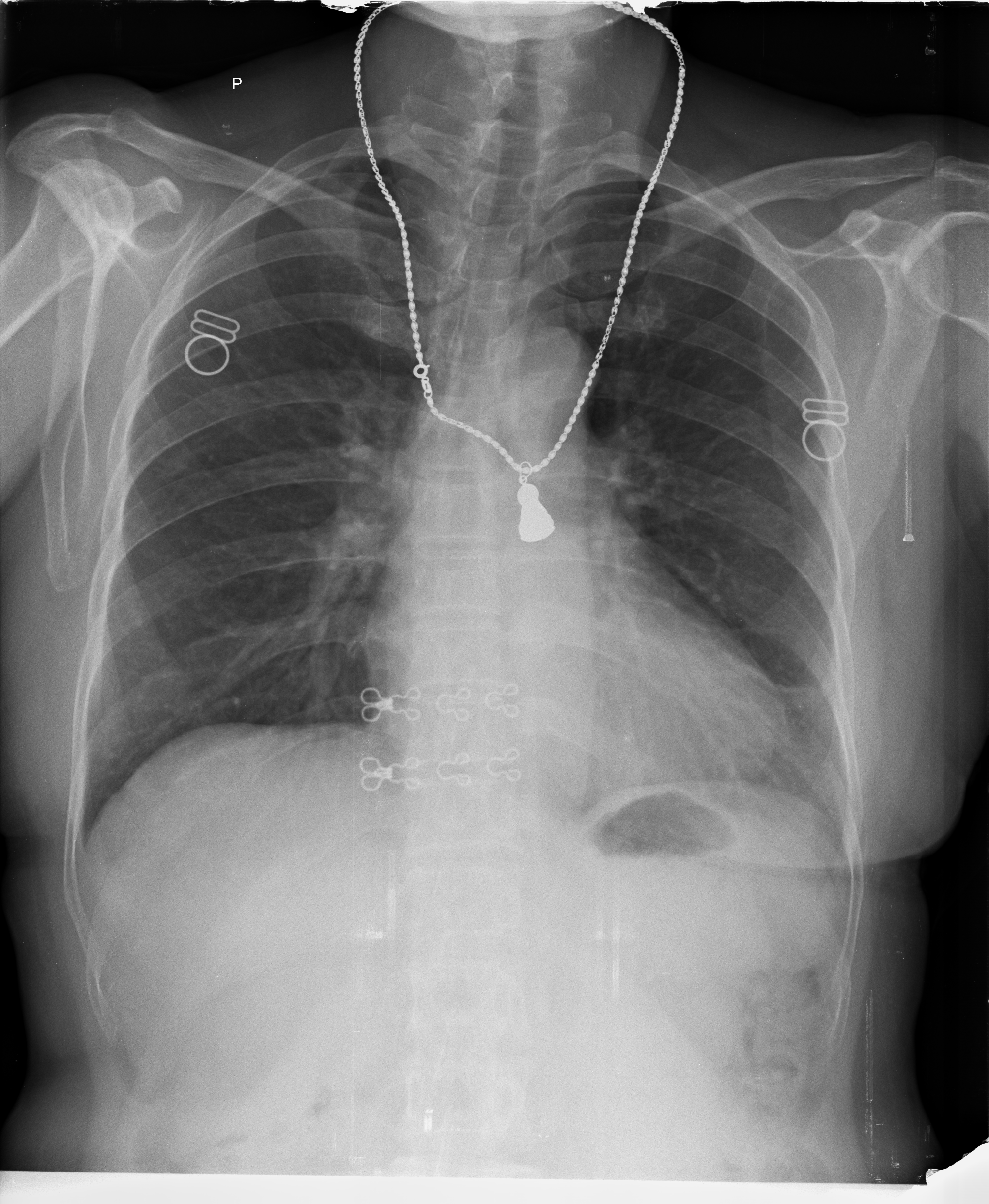 Ảnh 1