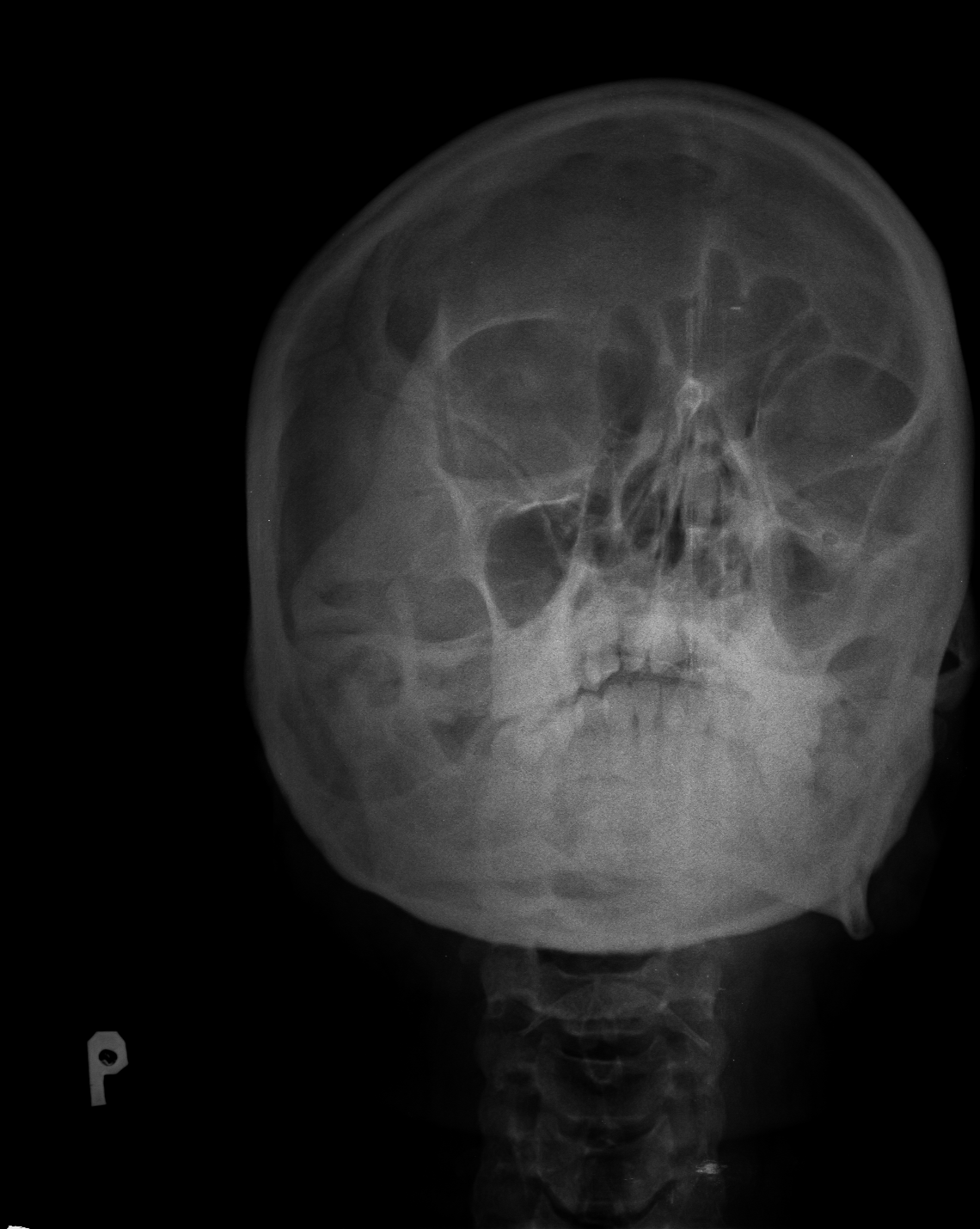 Ảnh 1