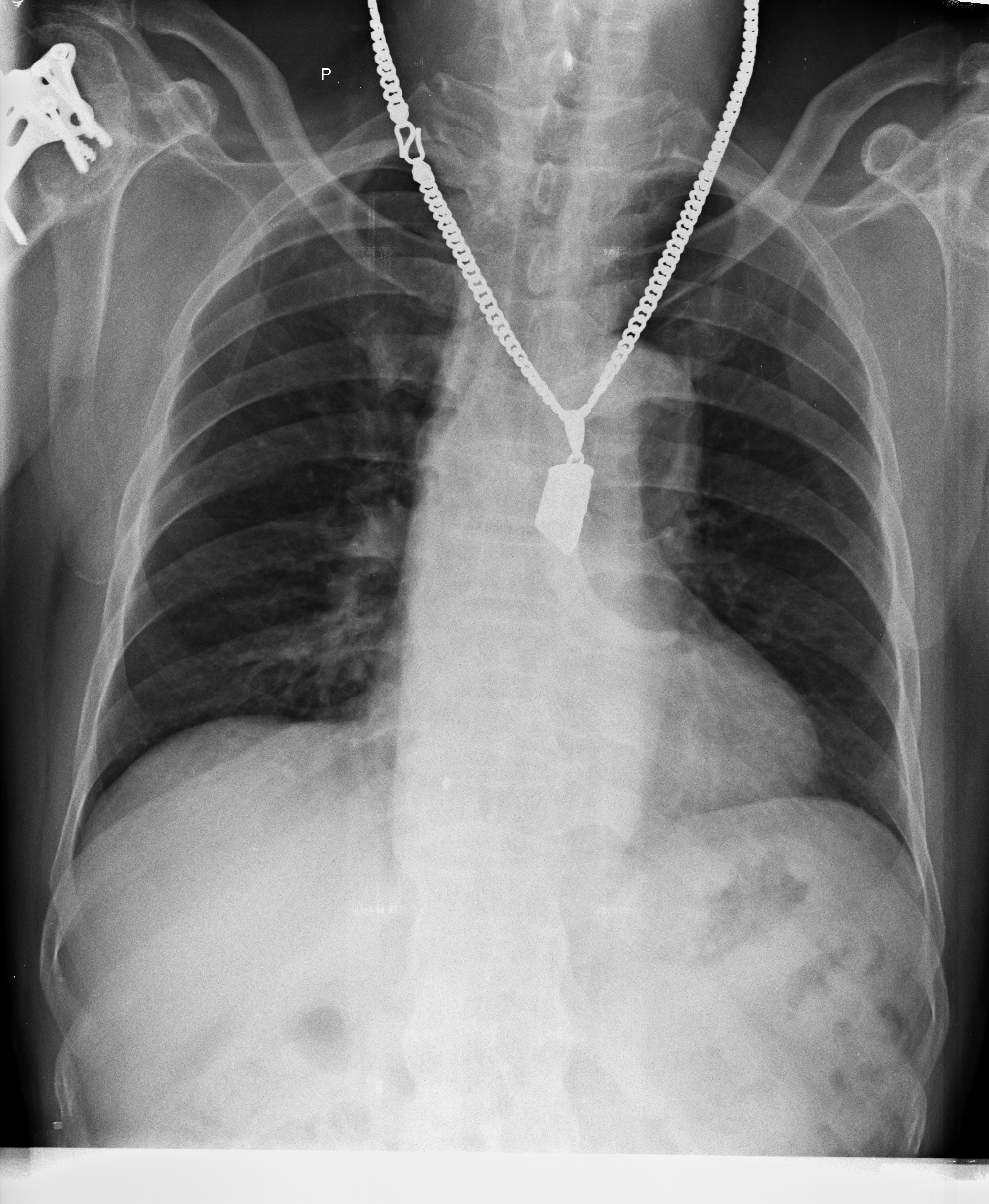 Ảnh 1