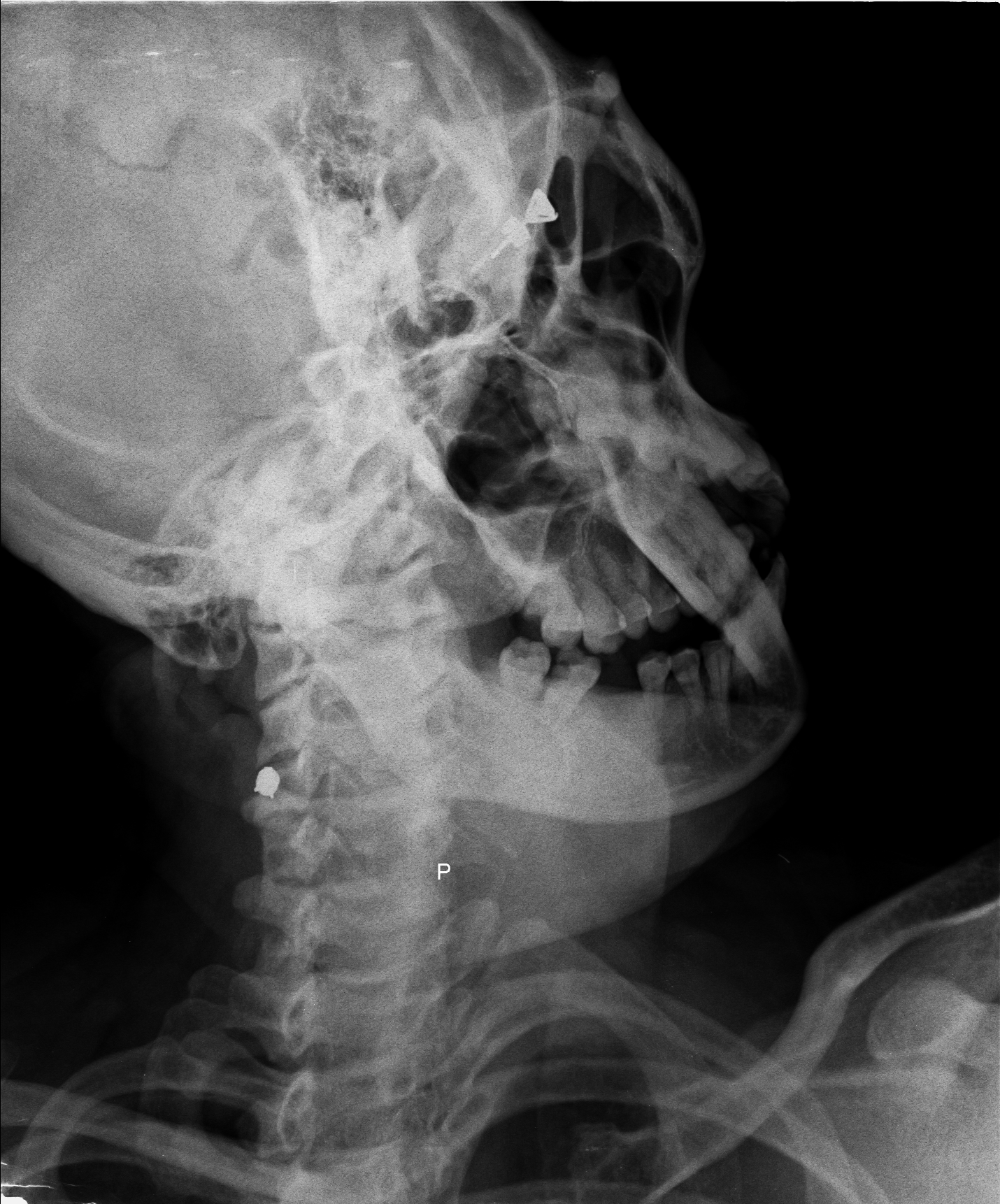 Ảnh 1